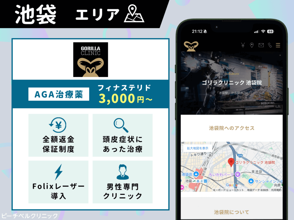 ゴリラクリニック池袋
