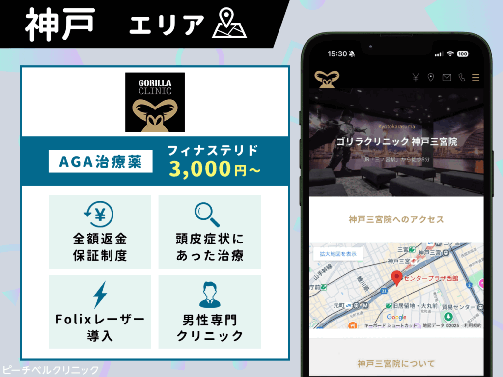 ゴリラクリニック神戸三宮院