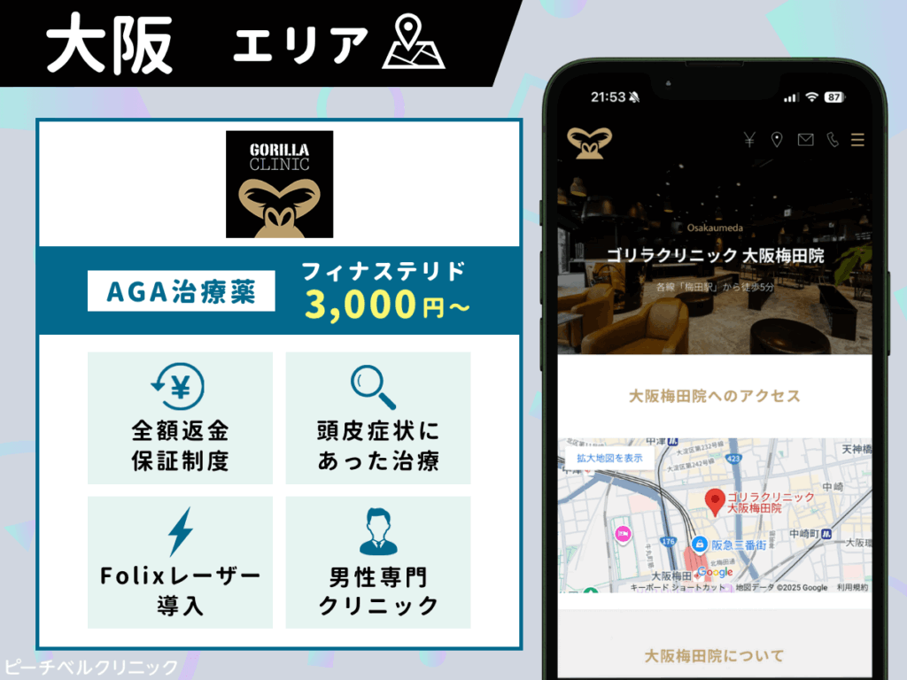 ゴリラクリニック大阪梅田院・心斎橋院