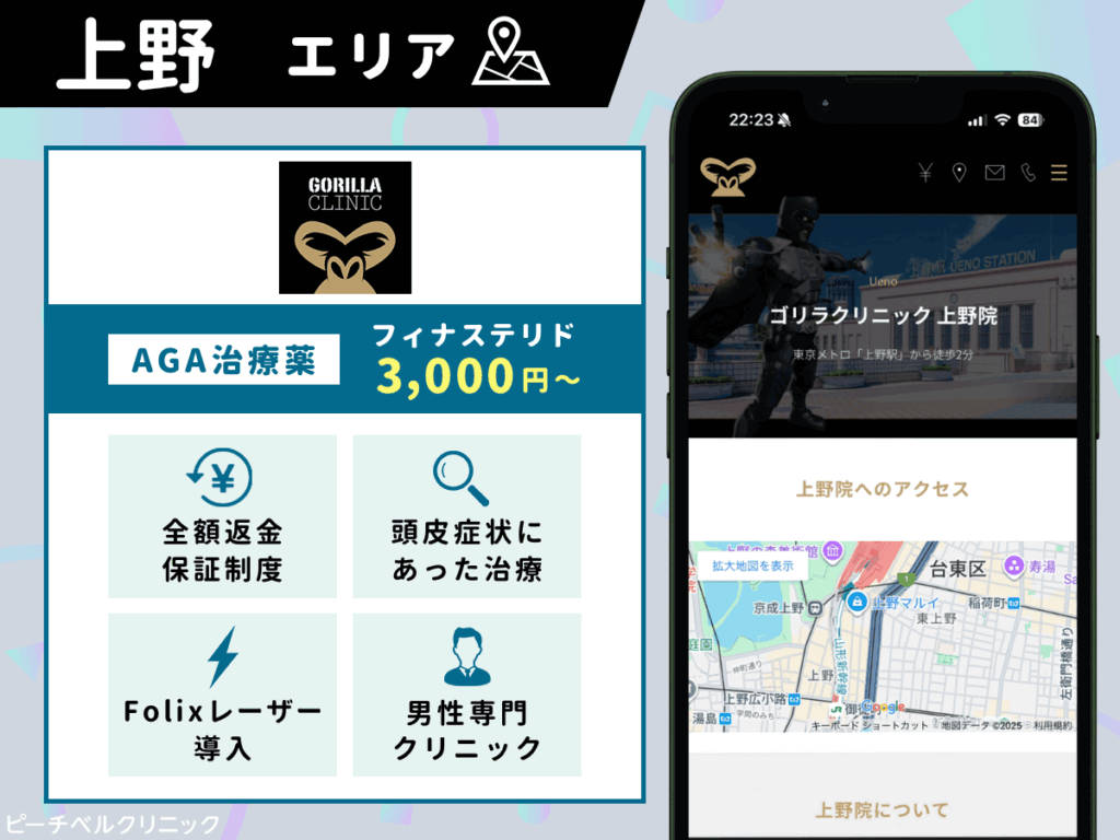 ゴリラクリニック上野院