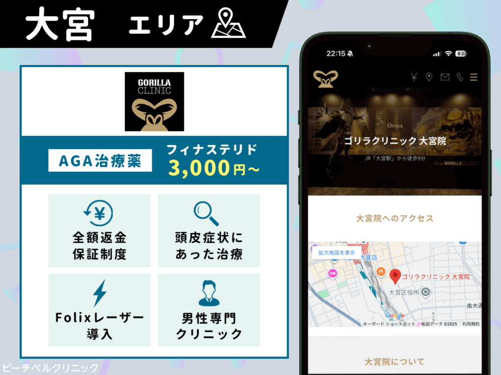 ゴリラクリニック大宮院